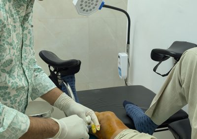 Hip Replacement Surgery | ACL reconstruction surgery